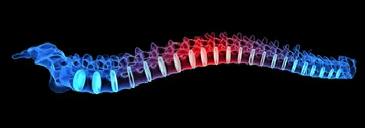 Neon Spine Illustrating Mid Back Pain